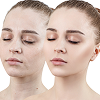 Cosmelan Treatment